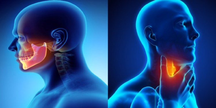 Head Neck Cancer