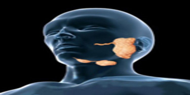 Salivary Gland Cancer